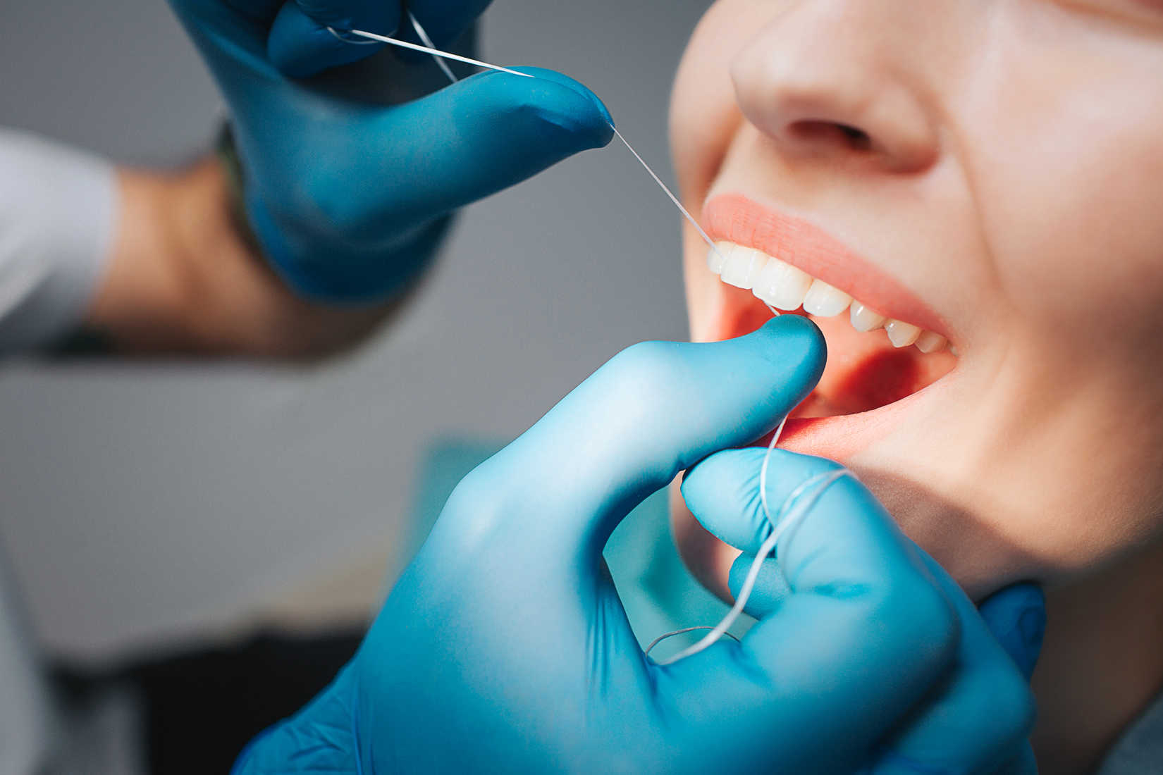 Implantes Dentales