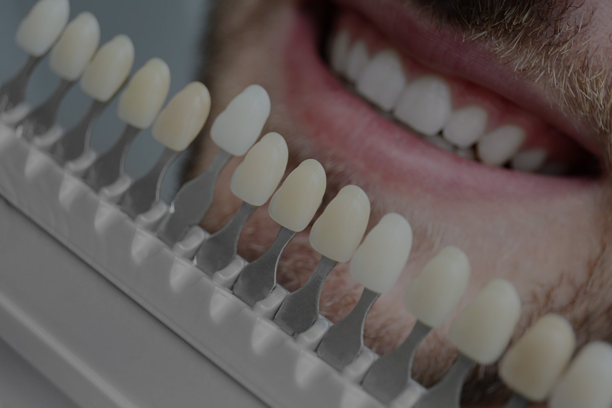 Estética Dental